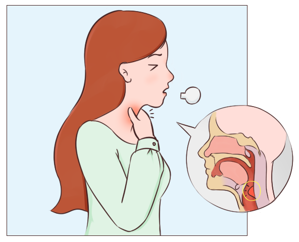 咽炎的症状有哪些症状，咨询下咽炎怎么治才能彻底除根