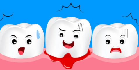 牙龈出血是什么原因？你的刷牙是否方式正确？快来看看