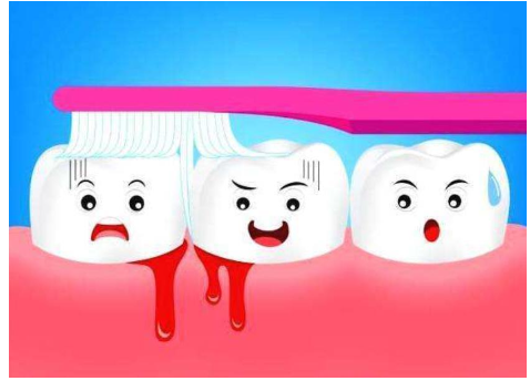 牙龈出血是什么原因(说一说牙龈老是出血什么原因)